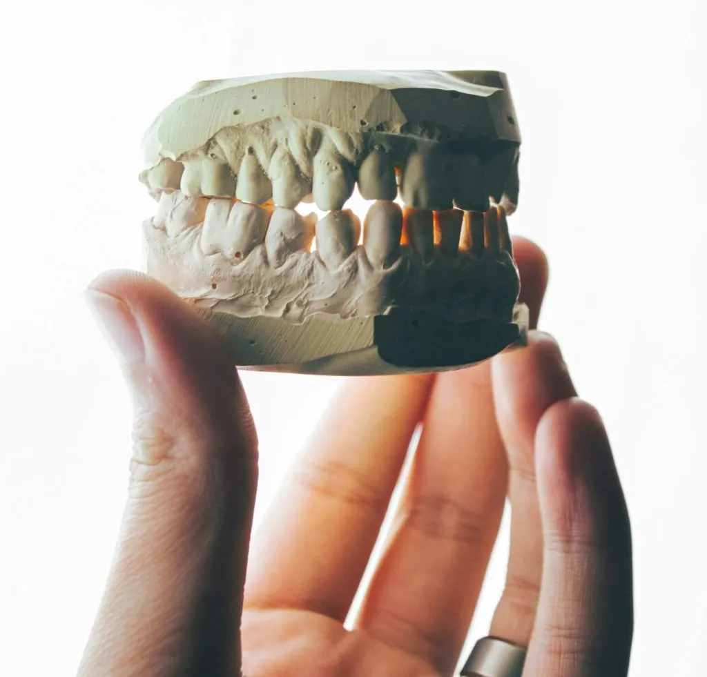 Dental jaw model, illustrating the area discussed in post-surgical jaw rehabilitation