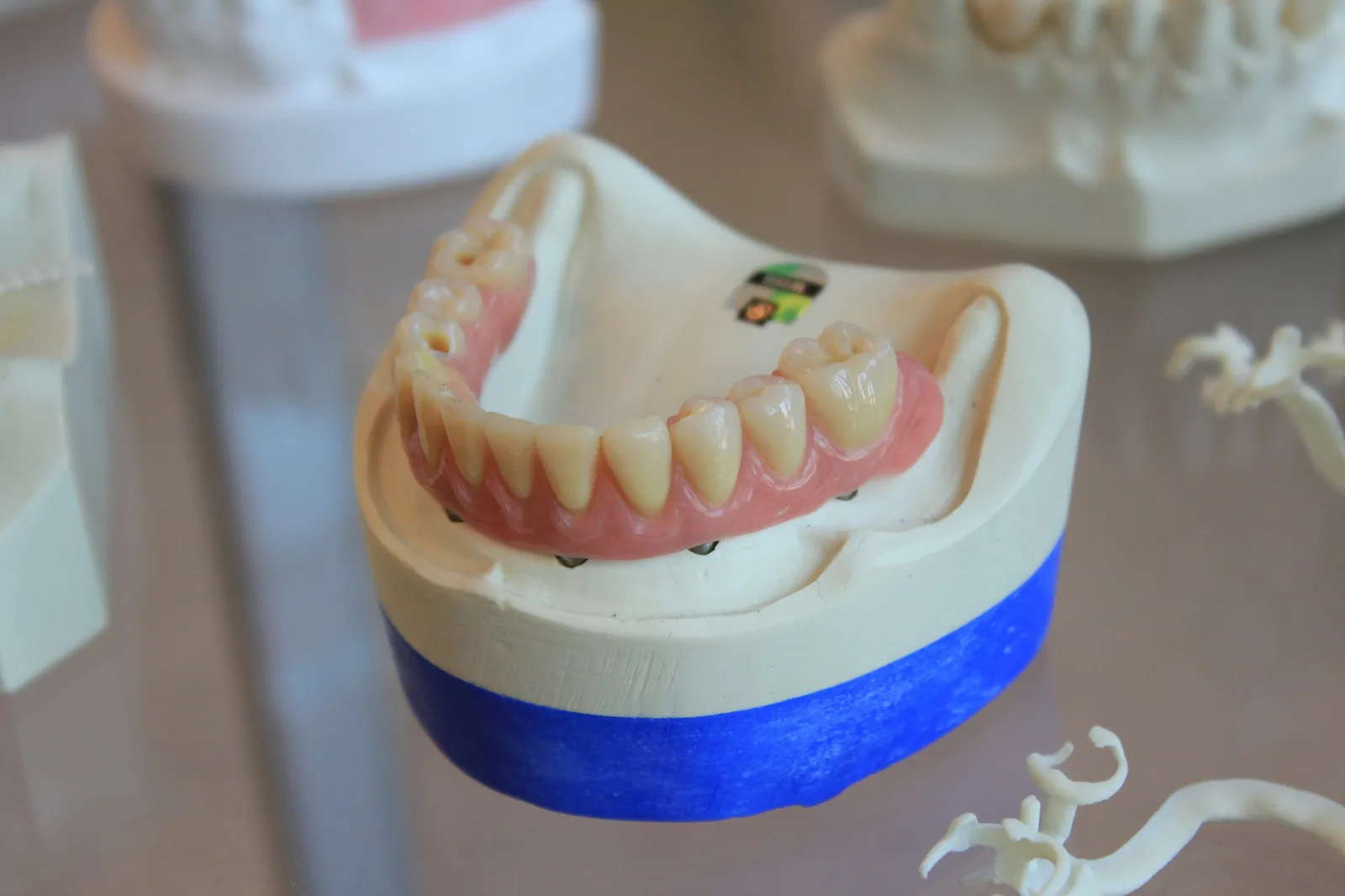 Modèle de mâchoire inférieure et de dents dans un laboratoire dentaire