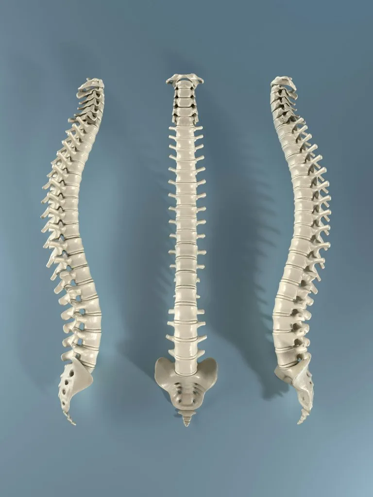 Three anatomical spine models showing different spinal curves