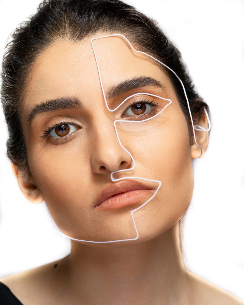 paralysie faciale