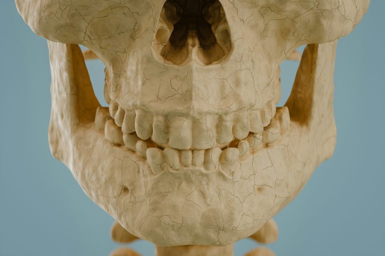 mâchoire traité par la kinésithérapie maxillo-faciale