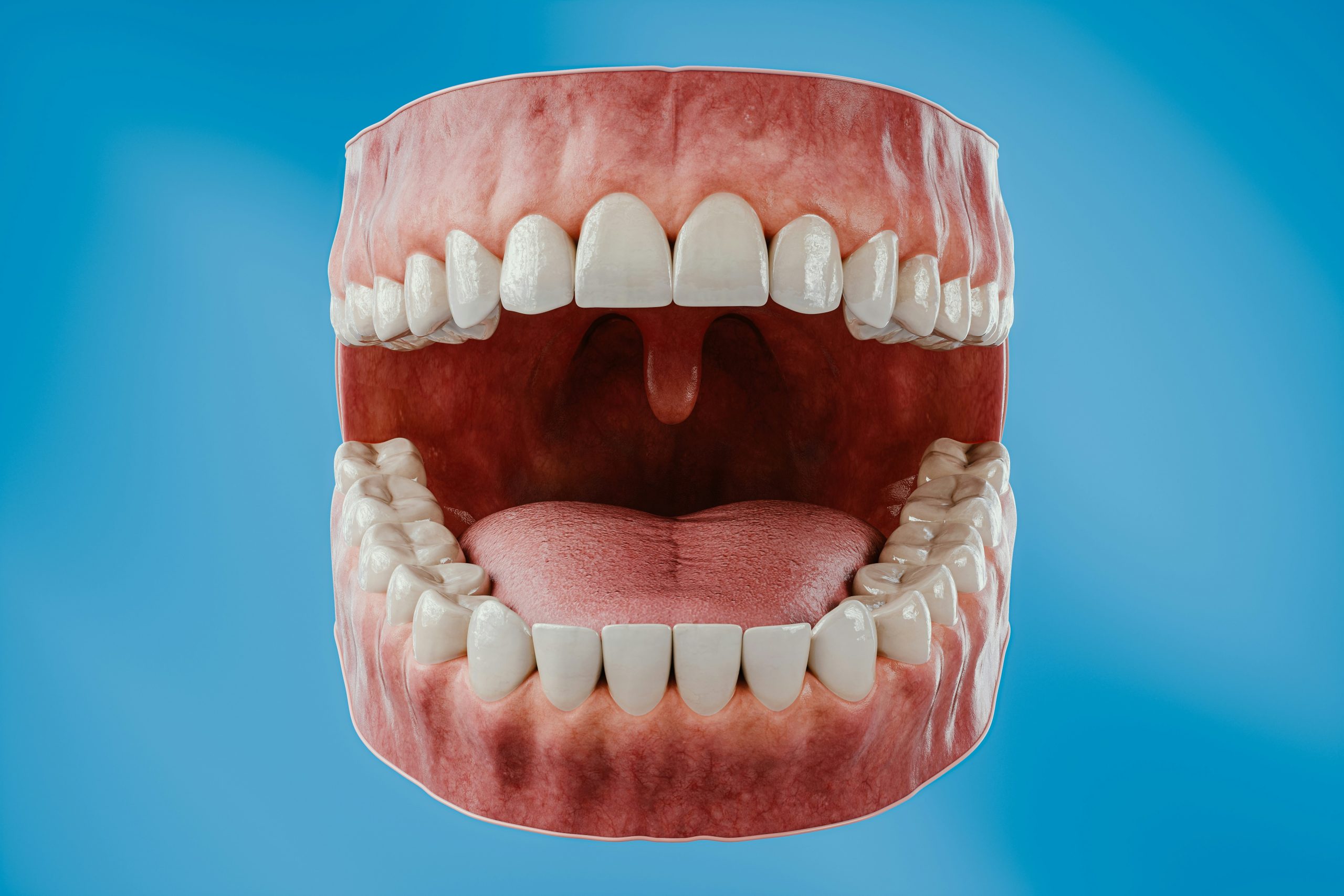 effet du bruxisme sur les dents