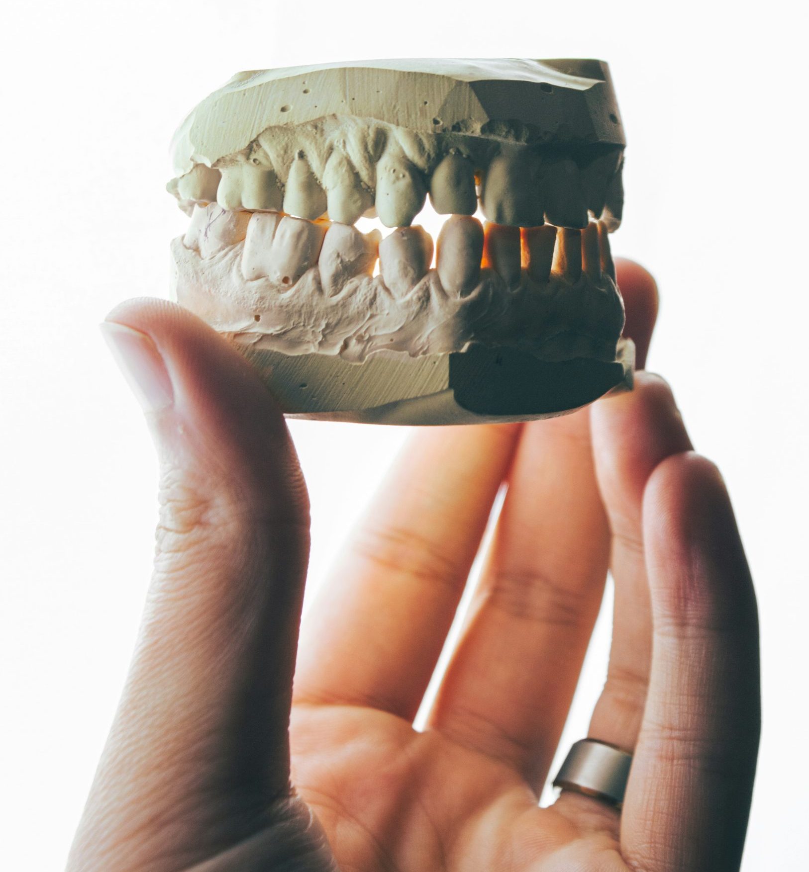 Effet du bruxisme sur les dents